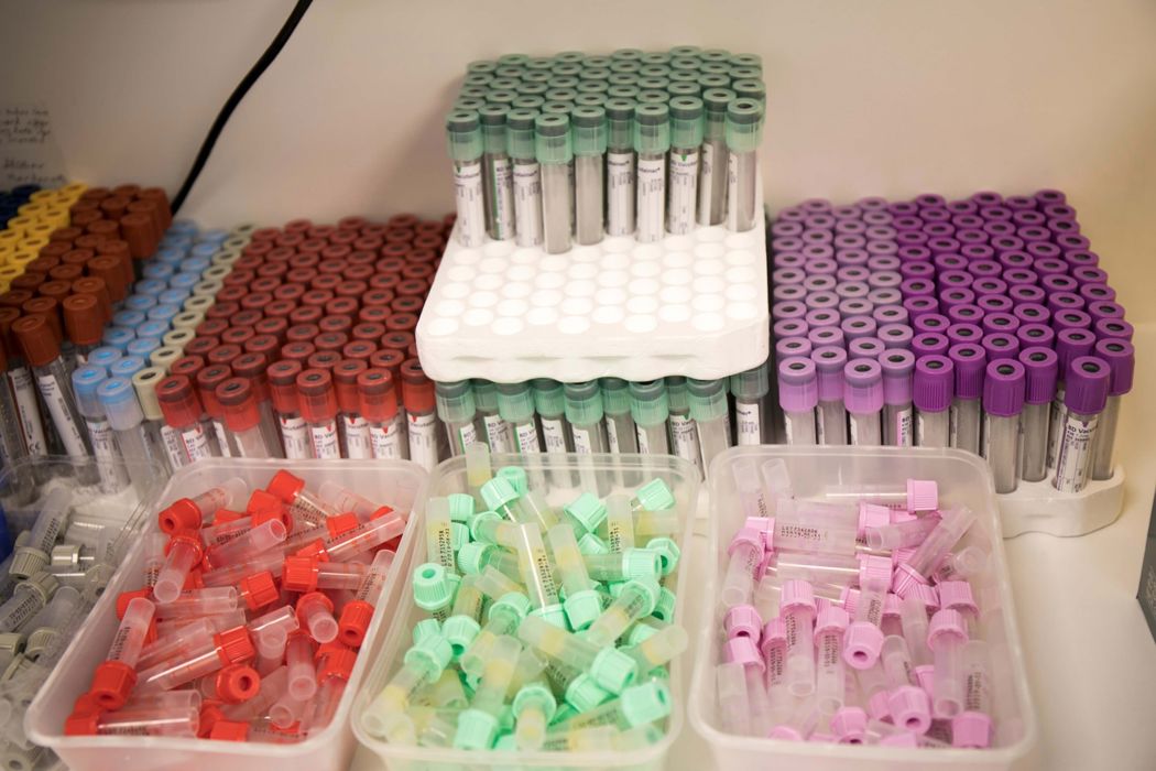blood test tubes.JPG